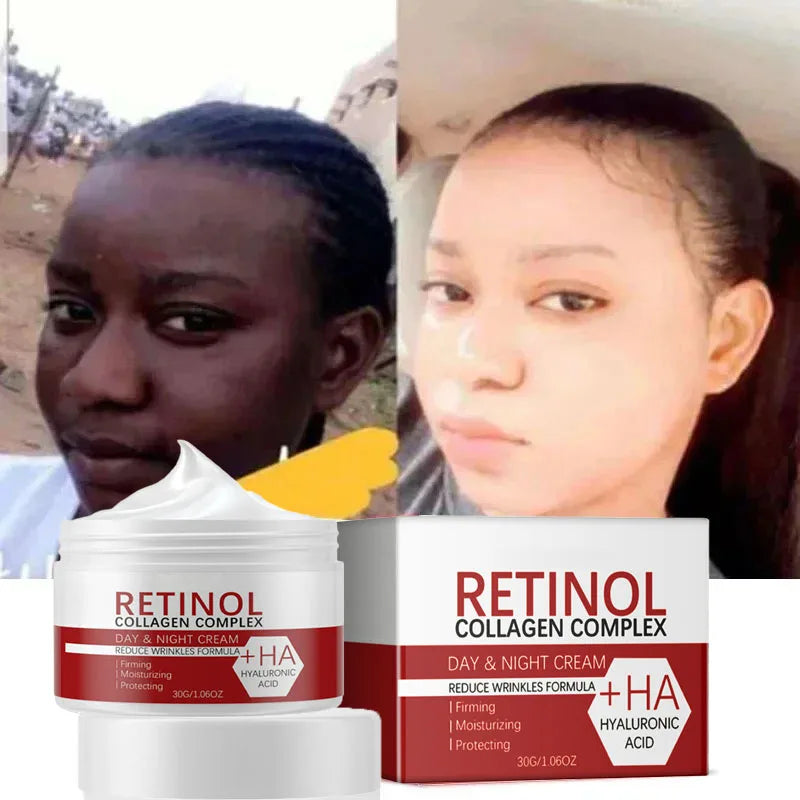 Retinol Collagen Hyaluronic Acid 3-in-1 Whitening Cream for Face & Body – Hydrating Dark Spot Care, Brightening & Even-Tone Skin Cream