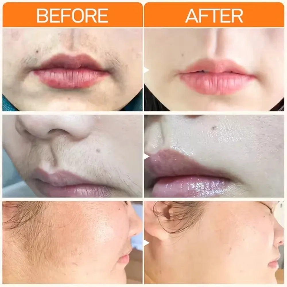 3-Minute Fast Hair Removal Cream for Women & Men – Gentle Depilatory for Face, Arms, Legs & Underarms, Smooth Skin Care