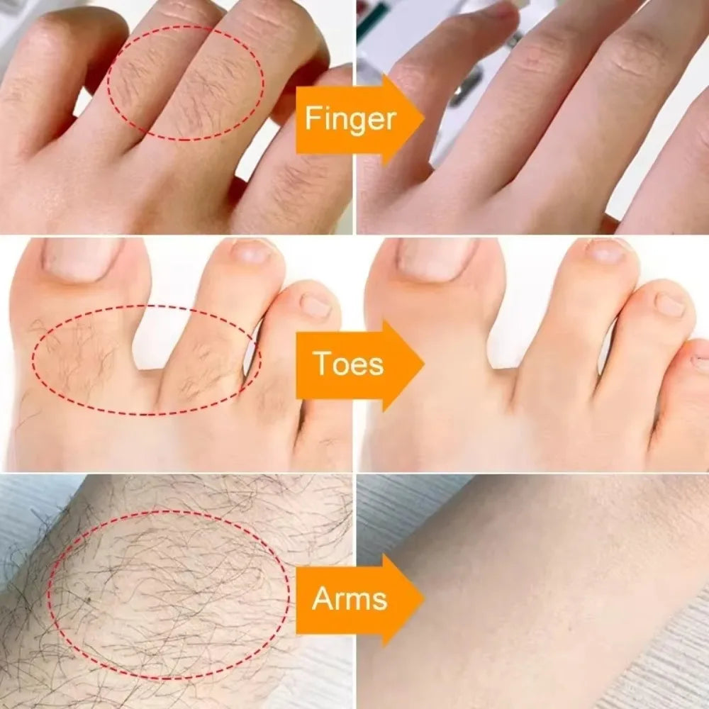 3-Minute Fast Hair Removal Cream for Women & Men – Gentle Depilatory for Face, Arms, Legs & Underarms, Smooth Skin Care