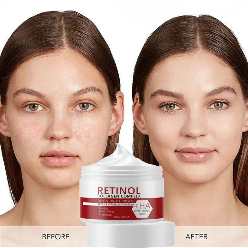 Retinol Collagen Hyaluronic Acid 3-in-1 Whitening Cream for Face & Body – Hydrating Dark Spot Care, Brightening & Even-Tone Skin Cream