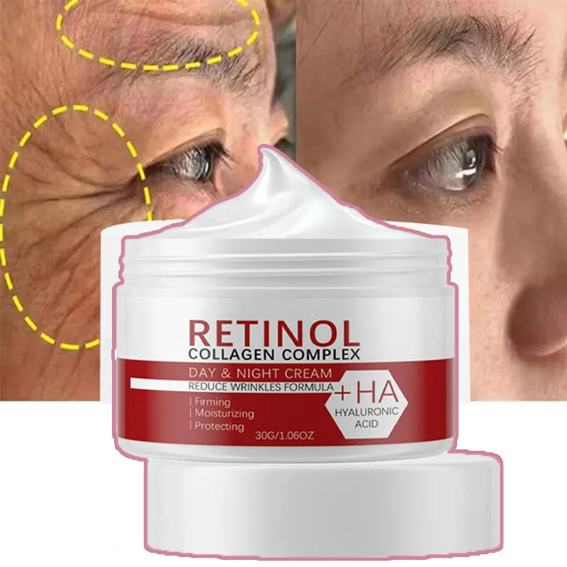 Retinol Collagen Hyaluronic Acid 3-in-1 Whitening Cream for Face & Body – Hydrating Dark Spot Care, Brightening & Even-Tone Skin Cream